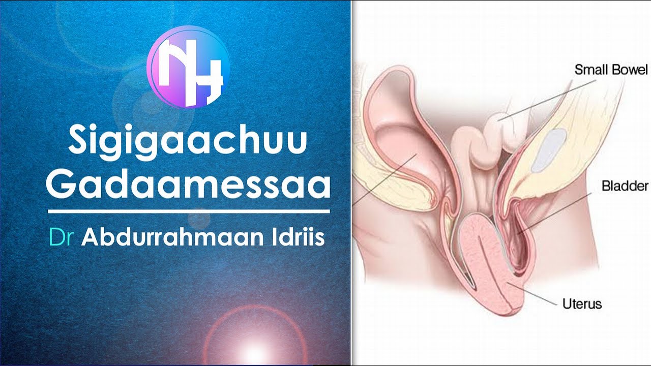 Sigigaachuu Gadaamessaa: Dr.Abdurrahmaan Idriis