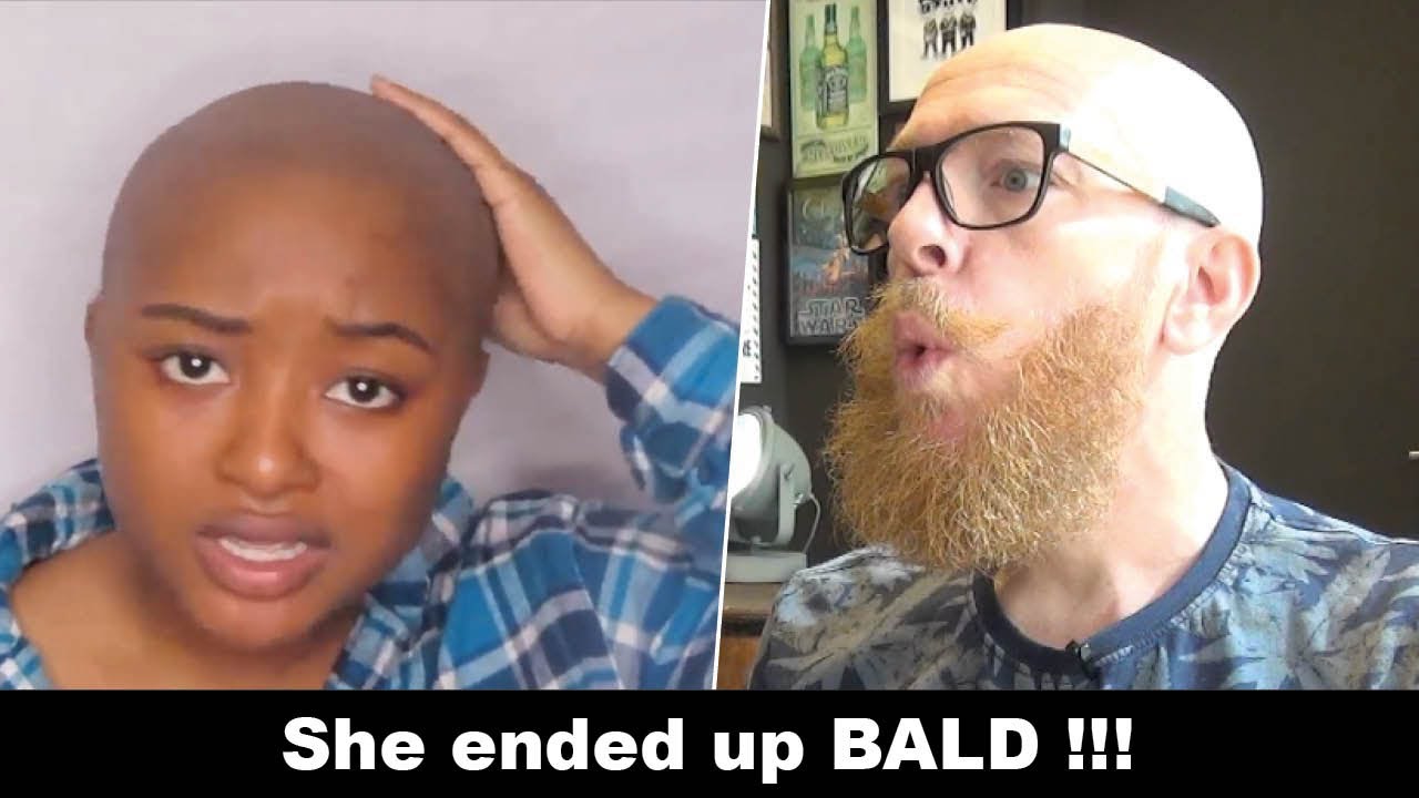 She Ended Up BALD?! Hairdresser Reacts to Shocking Hair Fail!