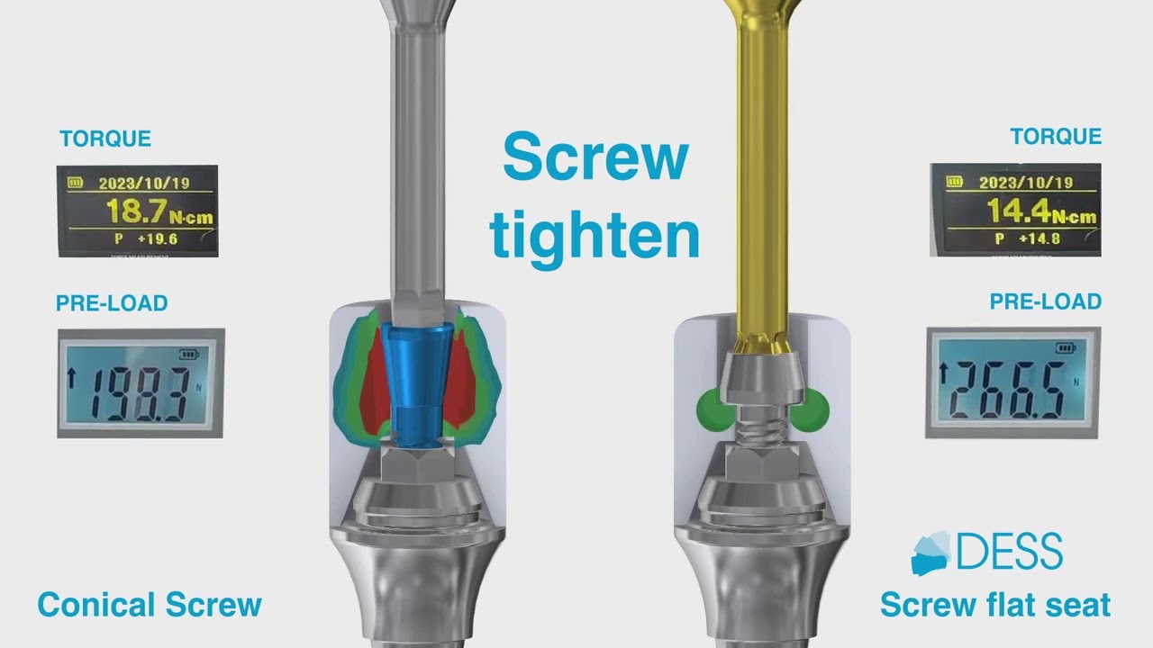 DESS Flat Seat Screw vs Conical Screw