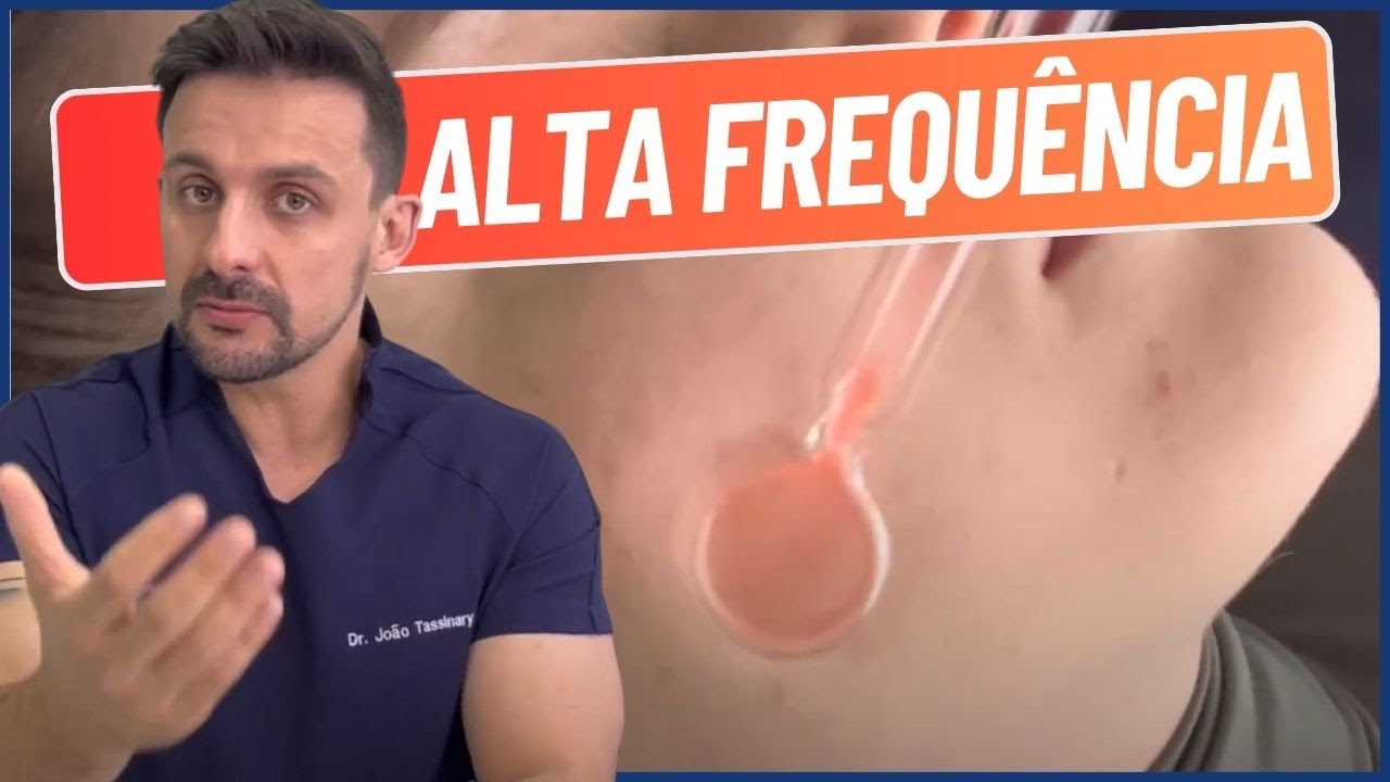 COMO APLICAR ALTA FREQUÊNCIA | DR. JOÃO TASSINARY