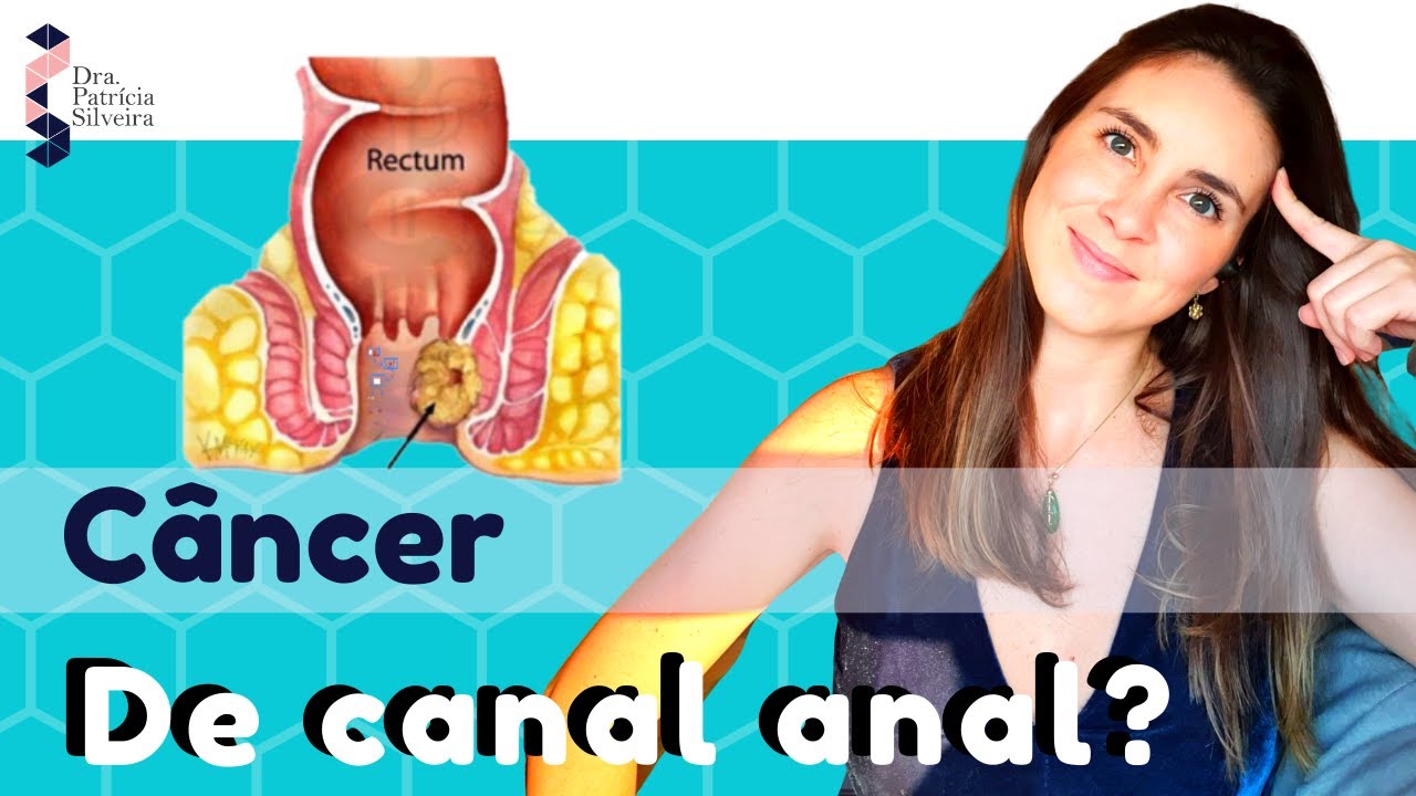 CÂNCER DE ÂNUS - É DIFERENTE DE CÂNCER DE INTESTINO?