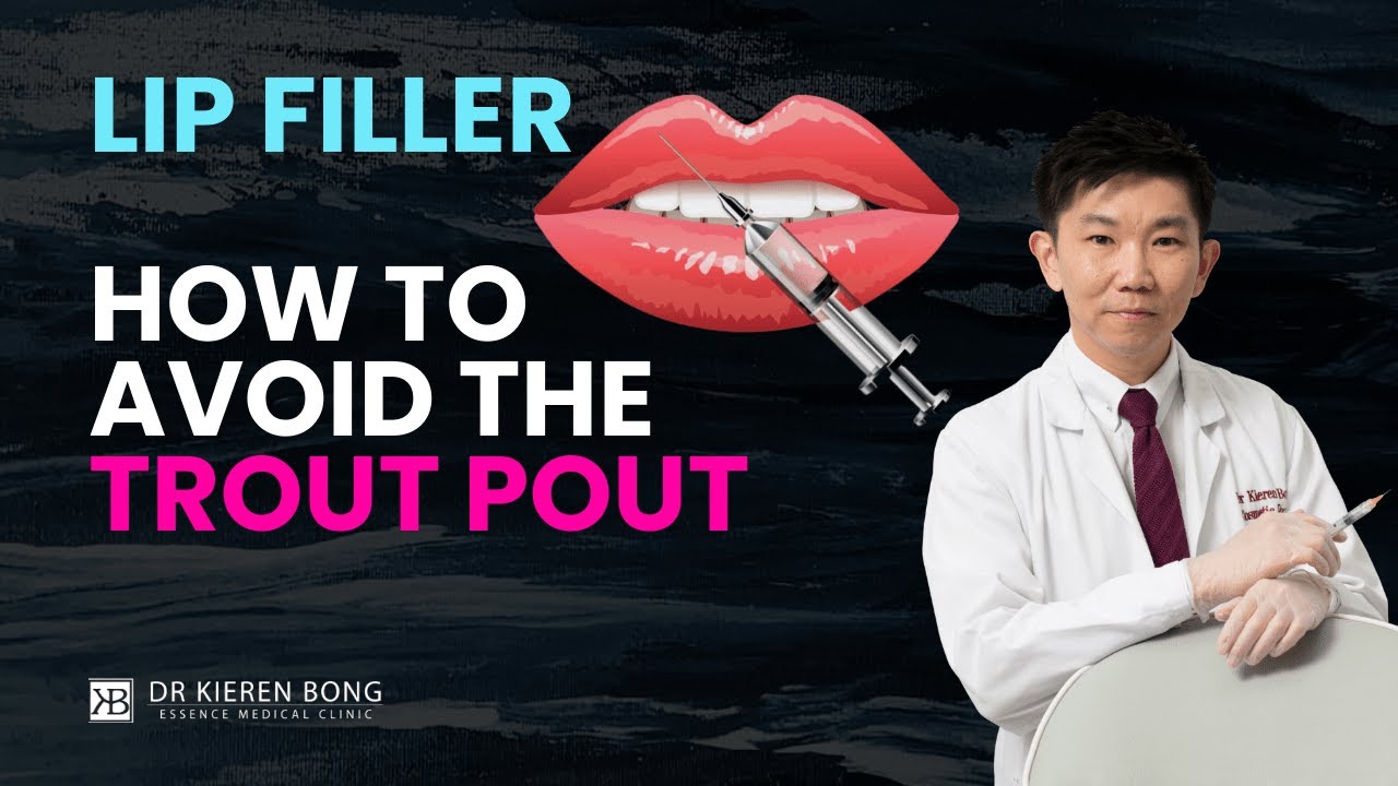 Lip fillers - HOW TO AVOID THE TROUT POUT. Advice from a cosmetic doctor
