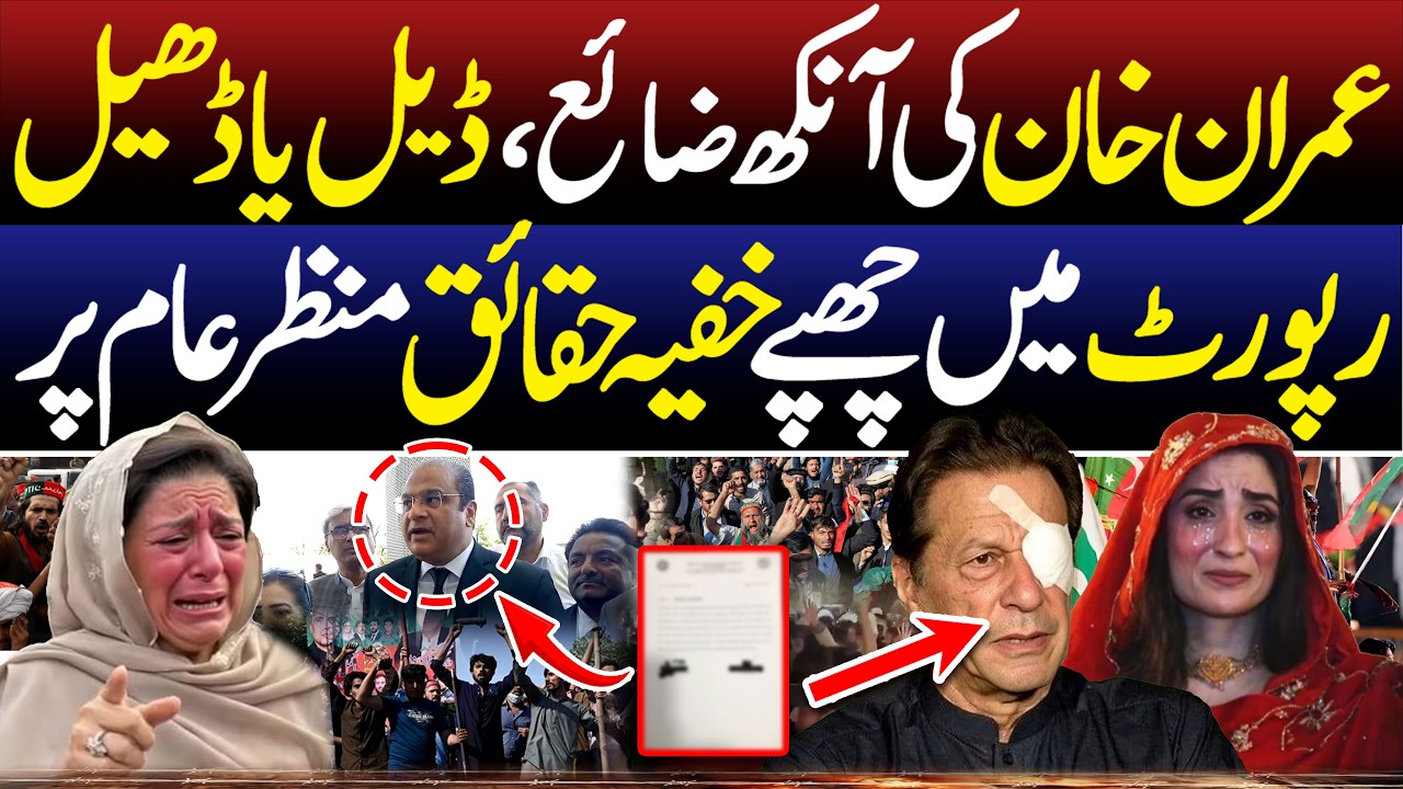 Imran Khan Right Eye Vision Update | Health Report Finally Revealed | SPD
