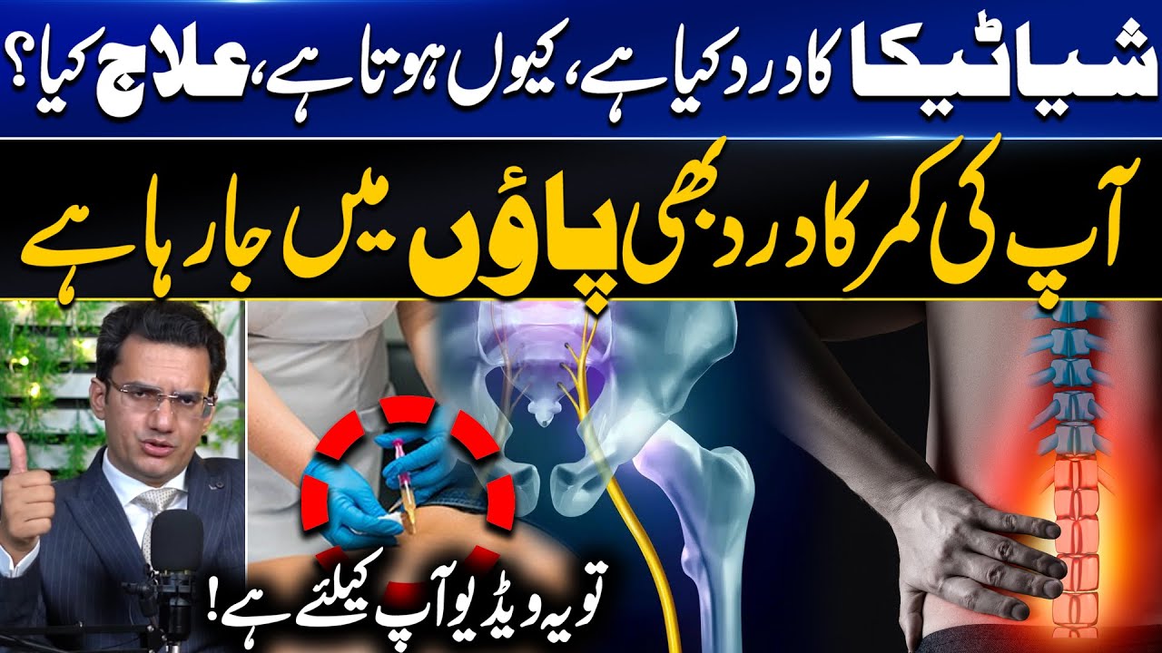 Best Treatment for Sciatica Pain & Its Causes |  شیاٹیکا درد کا بہترین علاج | Dr. Abdul Basit
