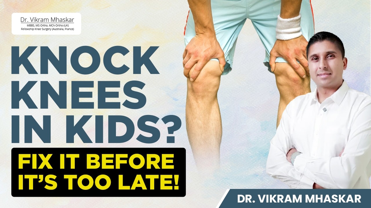 Knock Knees in Children – Causes, Myths & Best Treatment | Dr Vikram Mhaskar