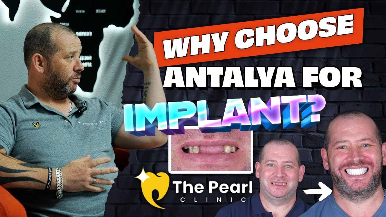 UK Patient’s All-on-6 Dental Implants Journey in Antalya  | Honest Review