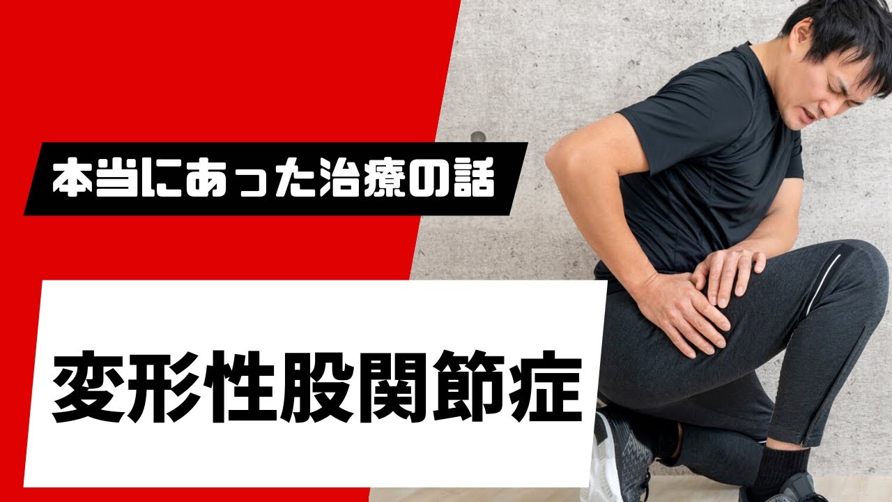 APS治療を受けるも改善しなかった中等度の変形性股関節症（APS治療、変形性股関節症）