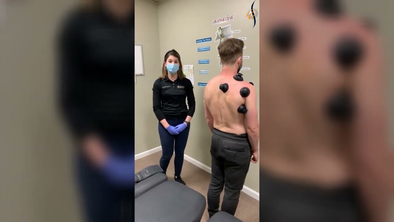 Stop Shoulder Pain with Functional Cupping