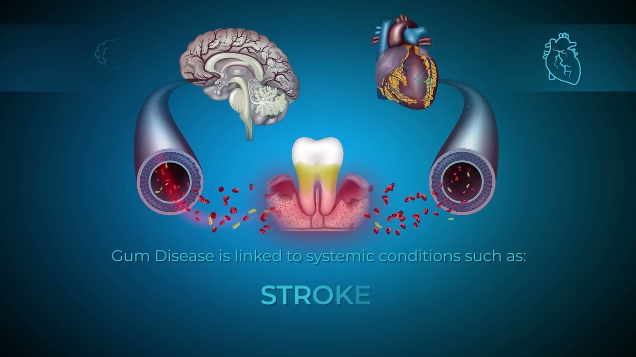 The Integral Connection Between Oral and Systemic Health