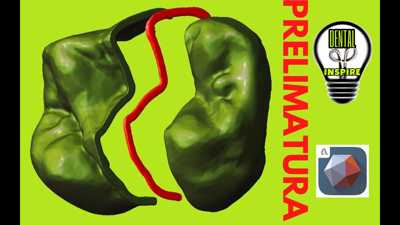 MESHMIXER DENTAL: PROVVISORIO PRELIMATURA