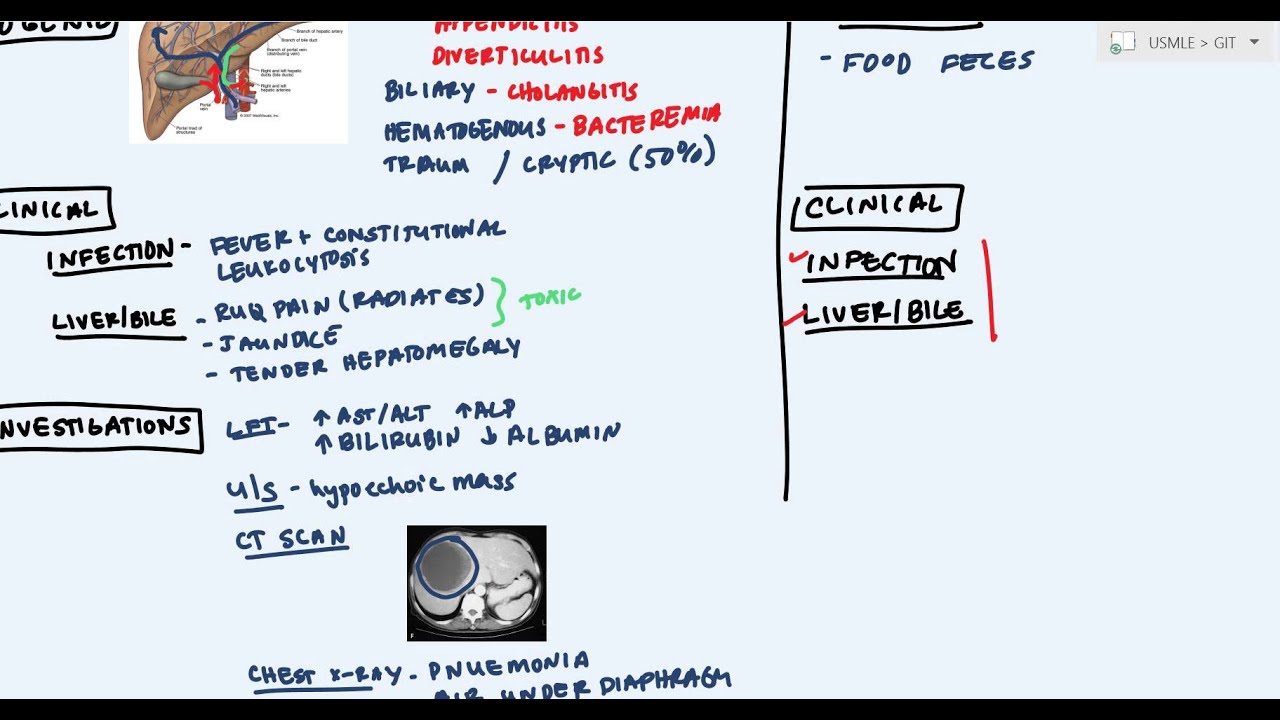 Hepatic Abscess or Liver Abscess (Pyogenic, Hydatid, Amoebic abscess)
