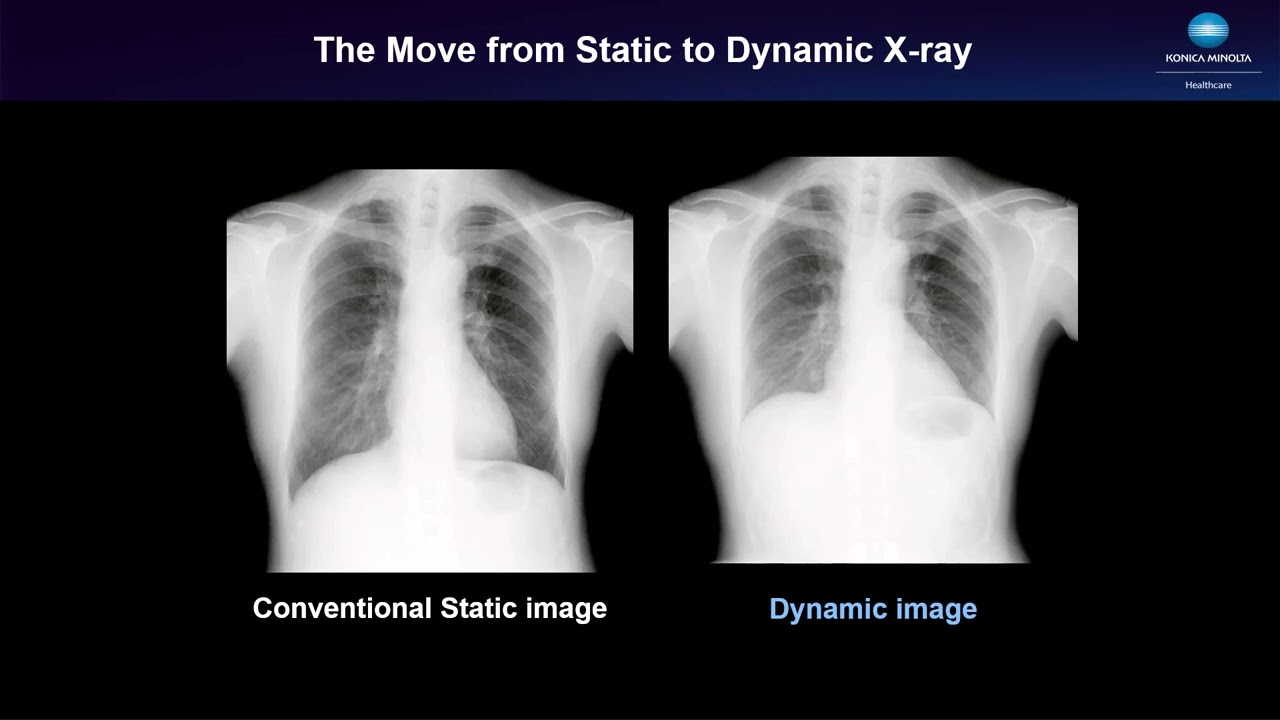 DDR for Pediatrics with Clinical Use Cases
