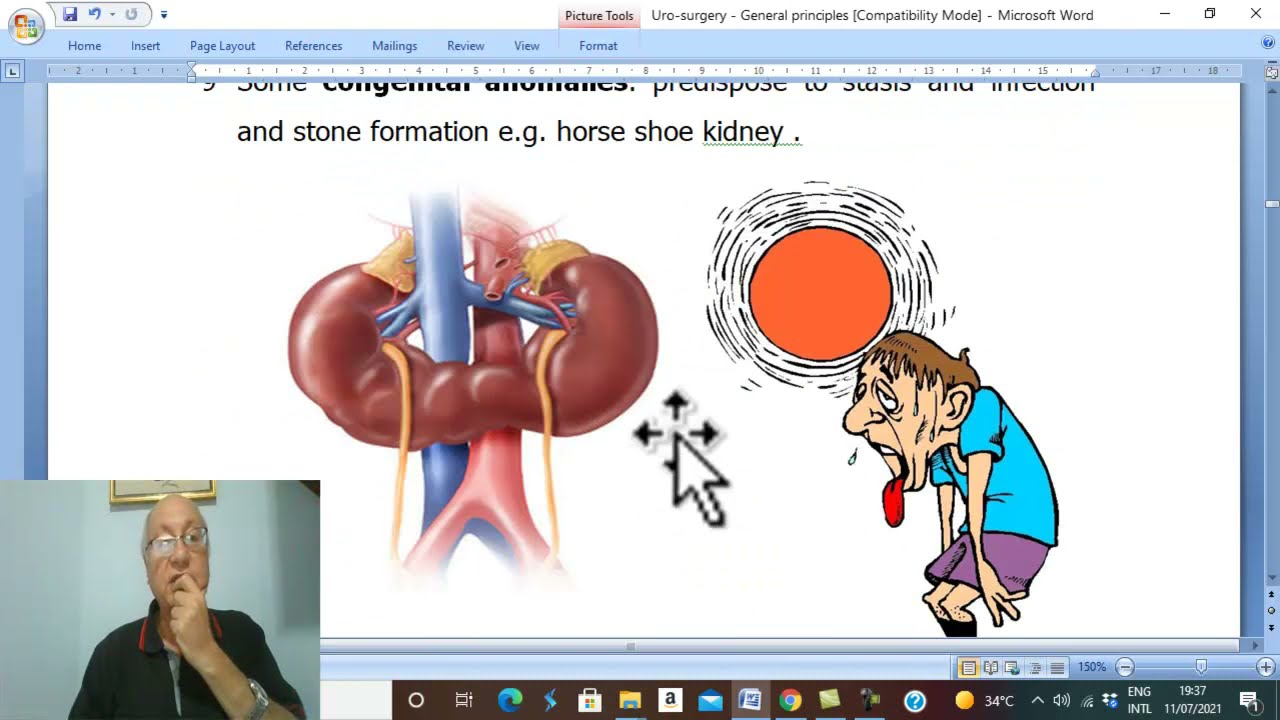 Urosurgery in Arabic 1 (Urinary Stones (General Principles ), part 1 ) , by Dr. Wahdan