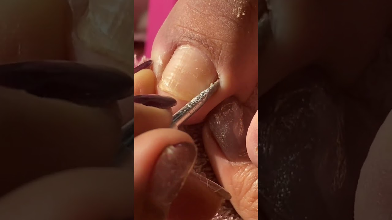Nails 