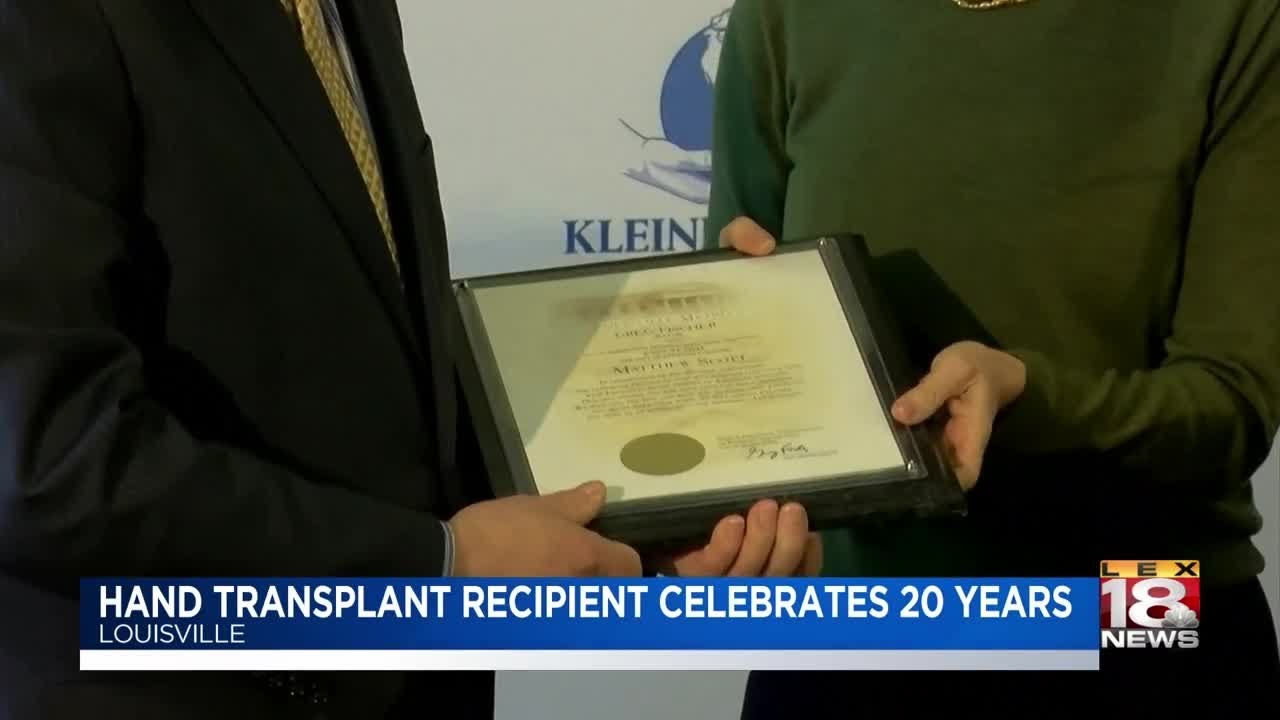 Hand Transplant Recipient Celebrates 20 Years