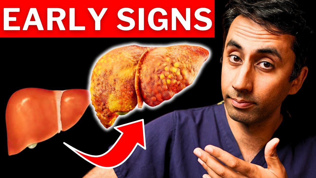 7 Signs of Undiagnosed Liver Disease In Adults