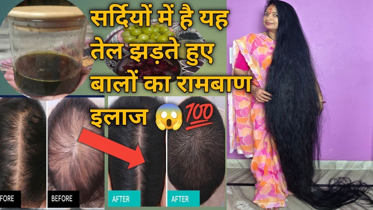 सर्दियों में इस तेल से गंजे सर पर भी उग आएंगे नए बाल 💯