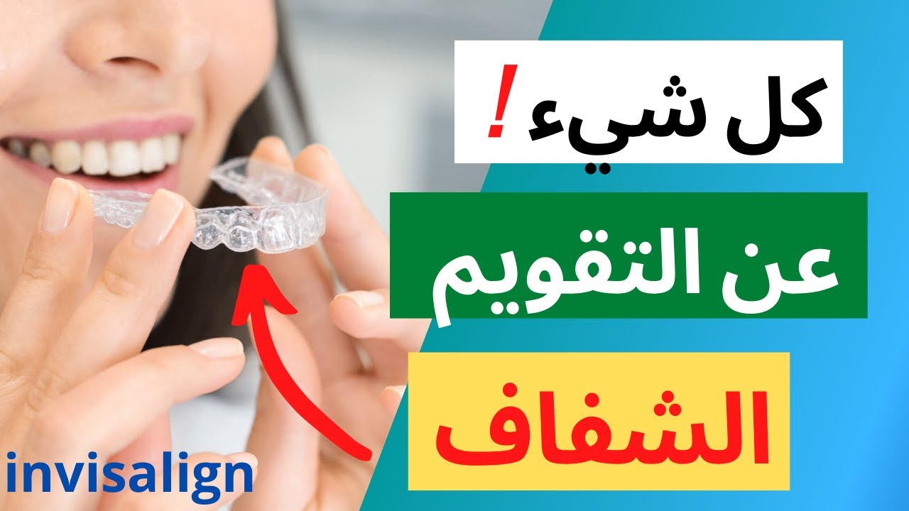كل ما يهمك عن التقويم الشفاف | شاهد قبل آن تقرر!!