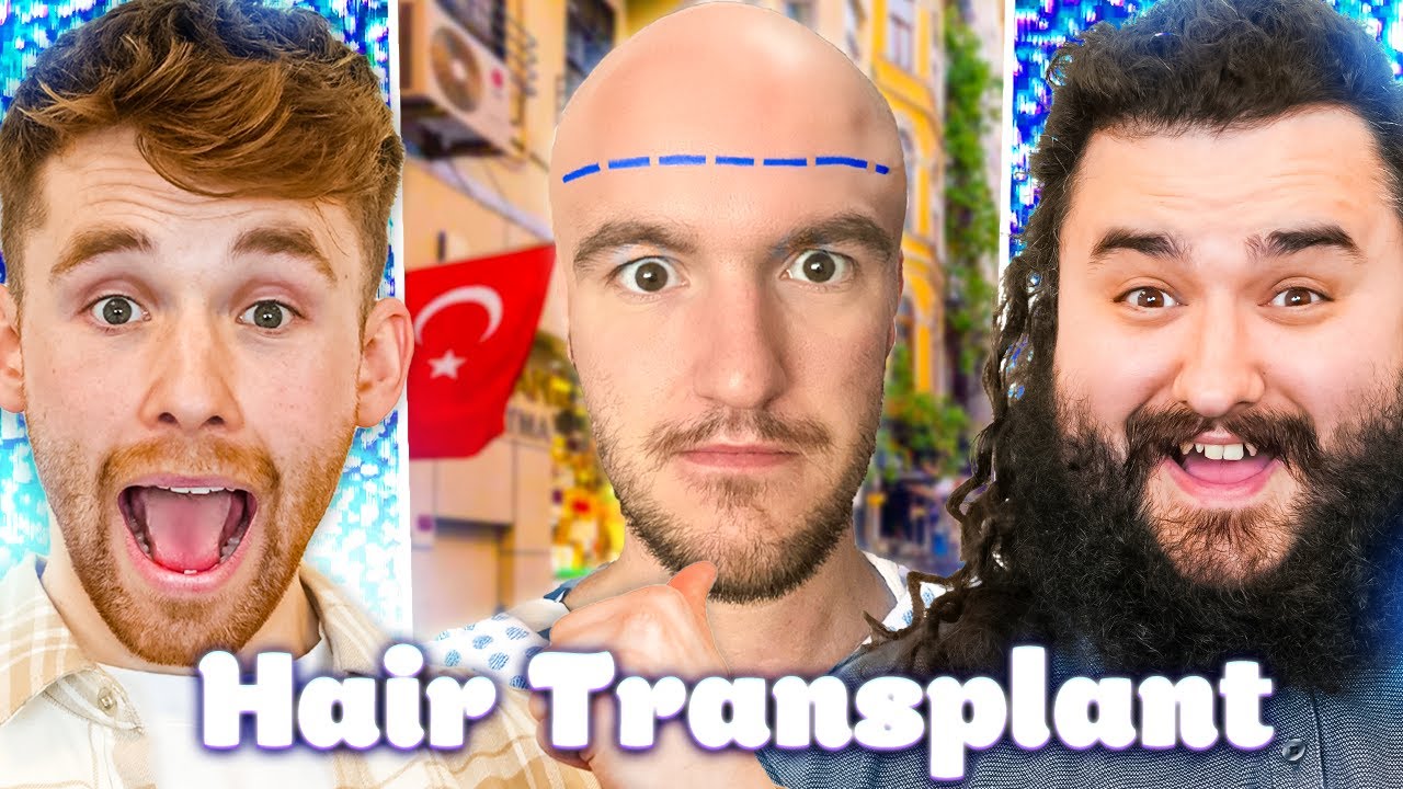 The Hair Transplant From Hell! | EP7