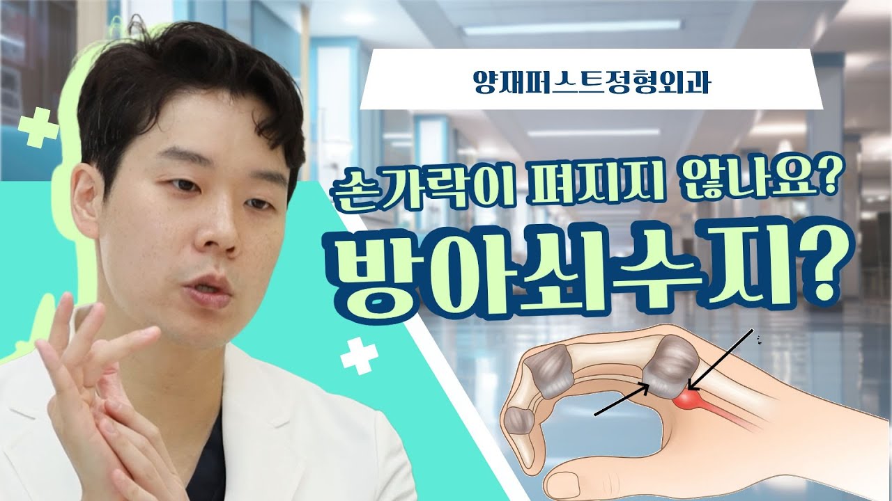 방아쇠수지, 저절로 낫는 병일까? | 양재퍼스트정형외과