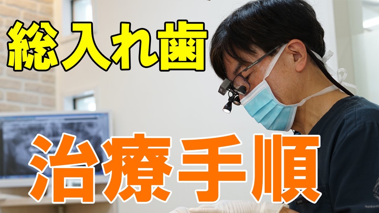 総入れ歯の治療の進め方を解説！すべての歯を失った方へ【岡山の歯医者さん】