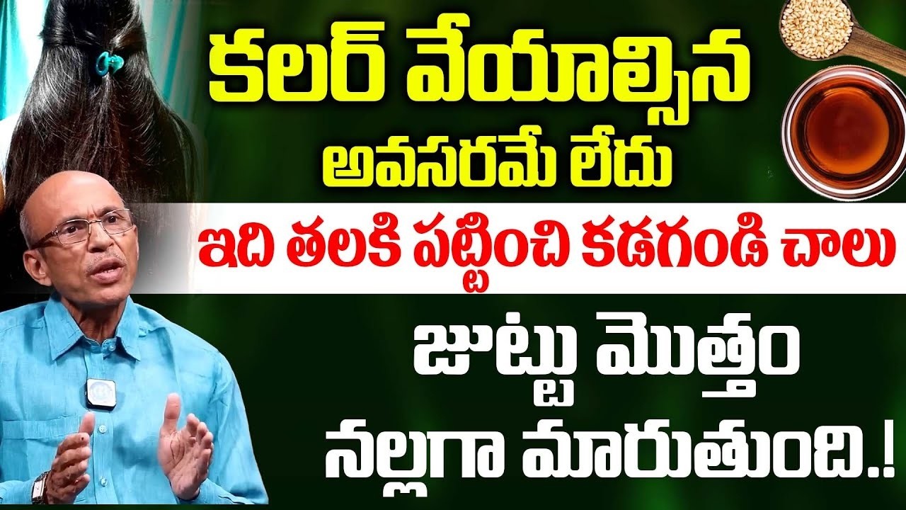 తెల్ల వెంట్రుకలు మాయం! — Dr.Madhusudhan Sharma | Hair Tips | Home Remedy | iDream Doctors