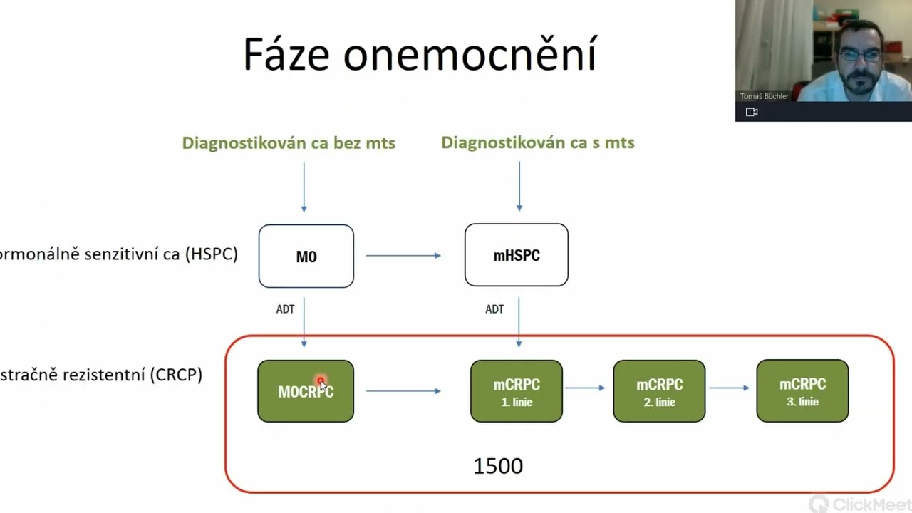 Karcinom prostaty - skríning a léčba