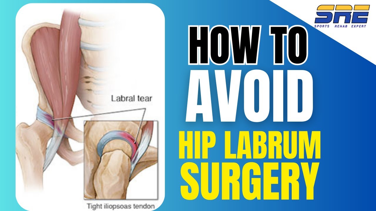 How to Avoid Hip Labrum Surgery