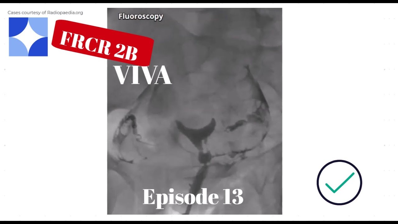 Episode 13: FRCR 2B viva experience part 6, GIT, GUT, Neuro and Nuclear Medicine cases