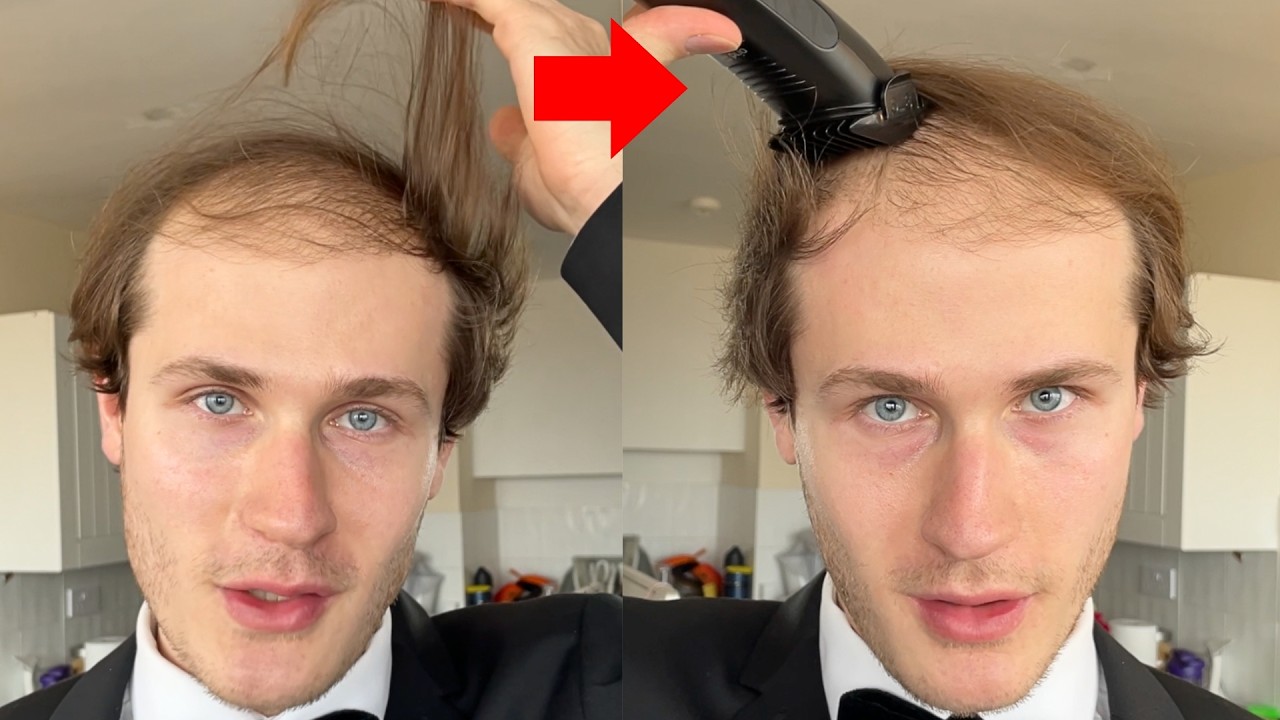 He REVEALED His BALDING HAIR Then SHAVED His Head