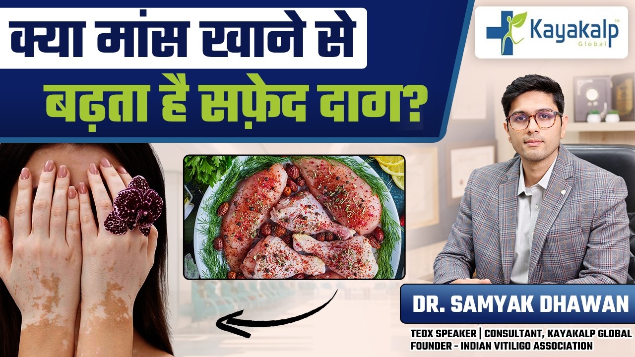 क्या Non-Veg खाने से बढ़ता है सफ़ेद दाग? | Vitiligo Diet Truth | Kayakalp Global