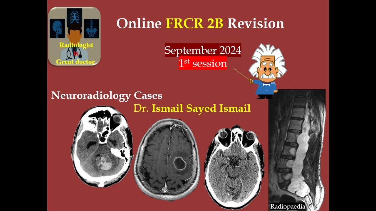 FRCR 2b Session 1 -September 2024 -CNS