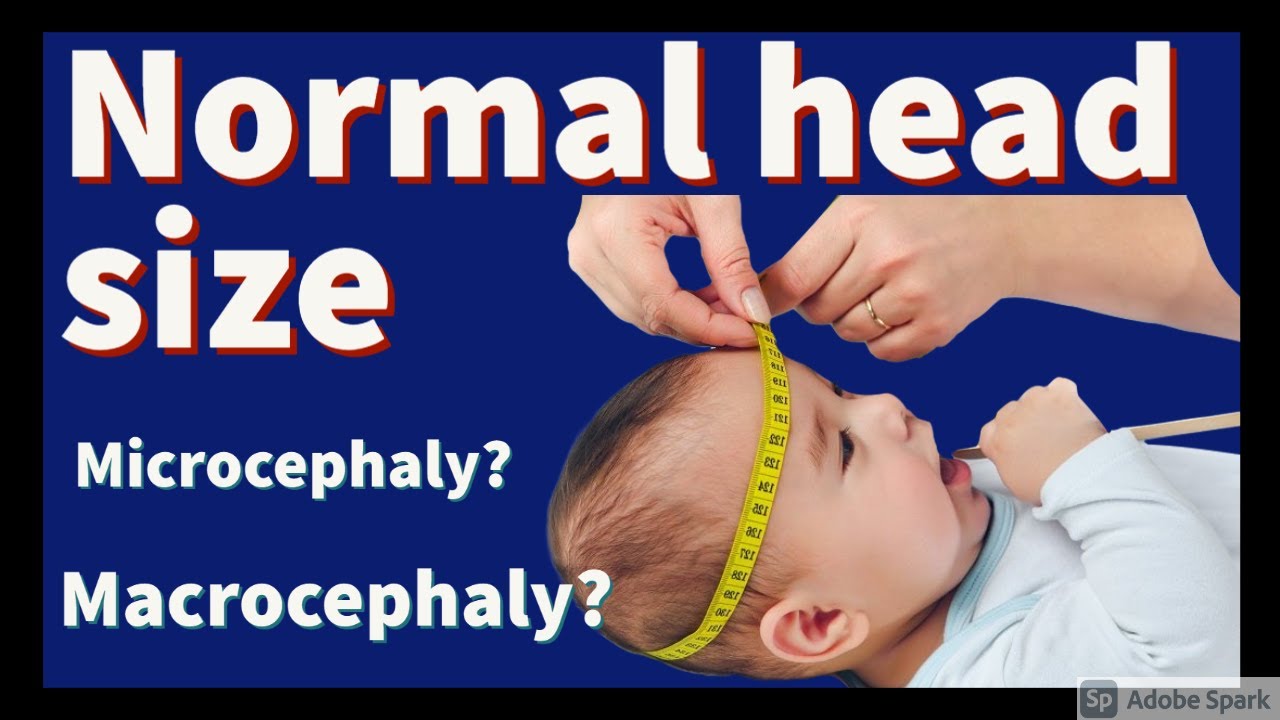 Session 4: Normal head size, microcephaly and macrocephaly