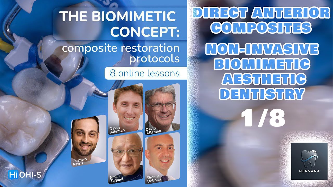 Direct Anterior Composites, Non Invasive Biomimetic Aesthetic