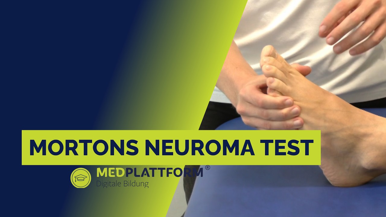 Mortons Neuroma Test / Mulder Click Test - Sprunggelenk/Fu&szlig;