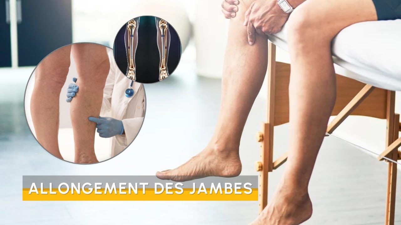 Allongement des jambes - Agrandir sa taille gr&acirc;ce &agrave; l'implant Fitbone
