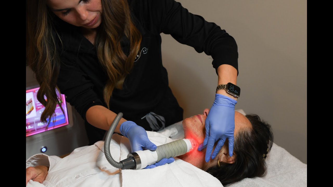 Vivace RF Microneedling on the Neck with Dr. Seiler in Birmingham, Alabama