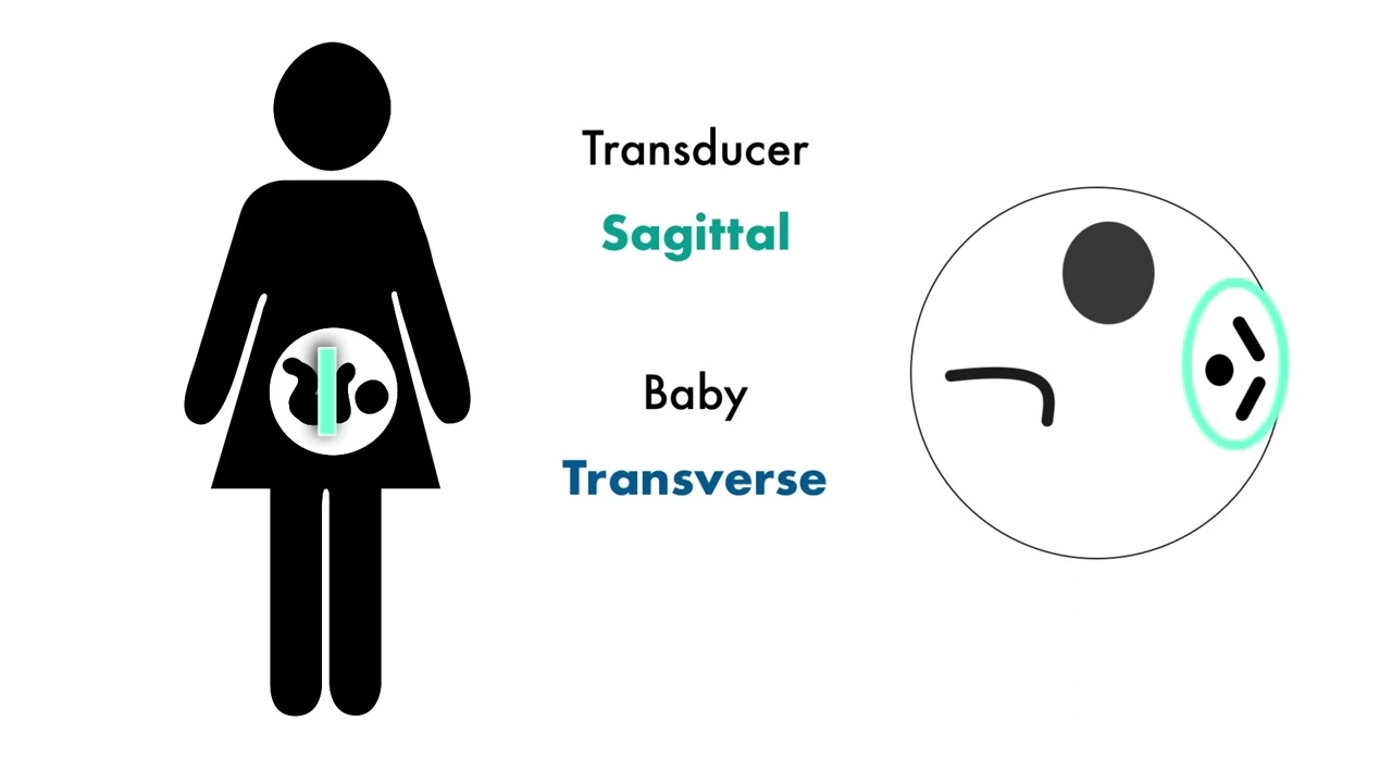 Excerpt Intro to 2nd trimester