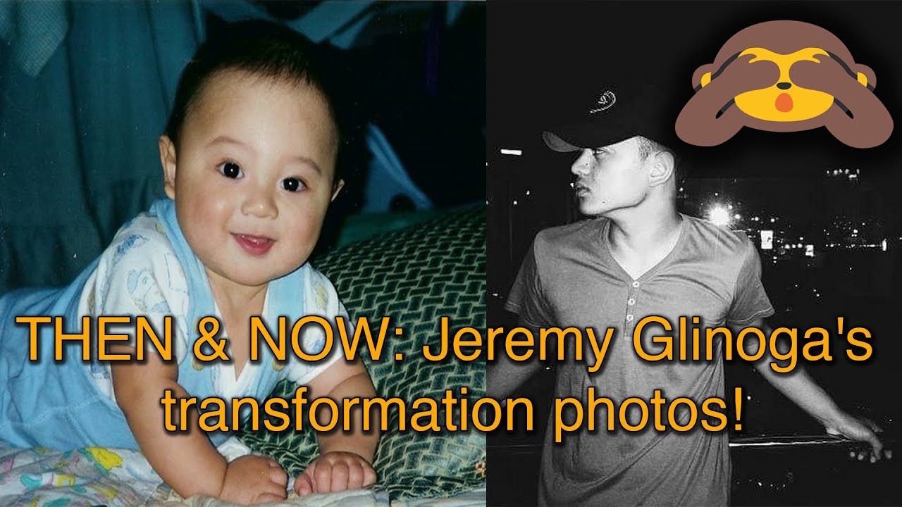 THEN & NOW  Jeremy Glinoga's transformation photos!