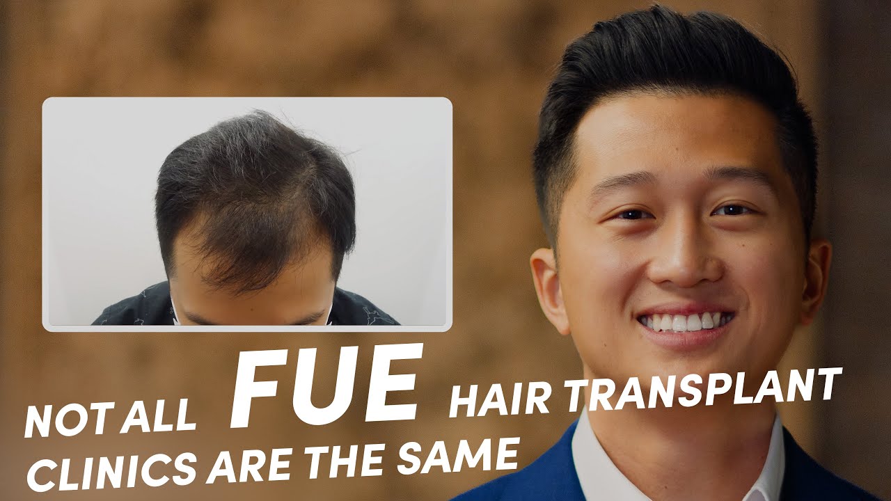 Advanced FUE™️ Hair Transplant | Advanced Hair