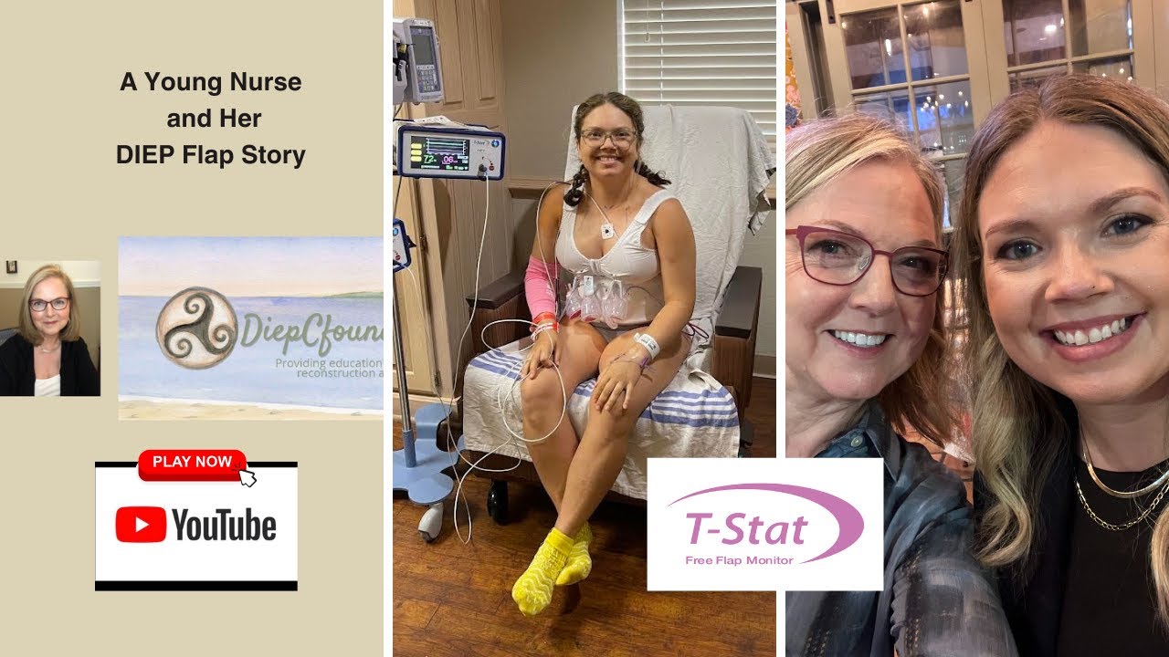 A Young Nurse and Her DIEP Flap Story
