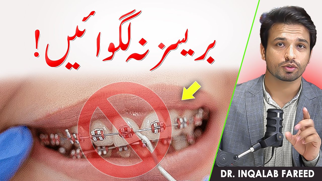 Never Get Braces before Watching this | Dentist Explains |@InqalabFareed