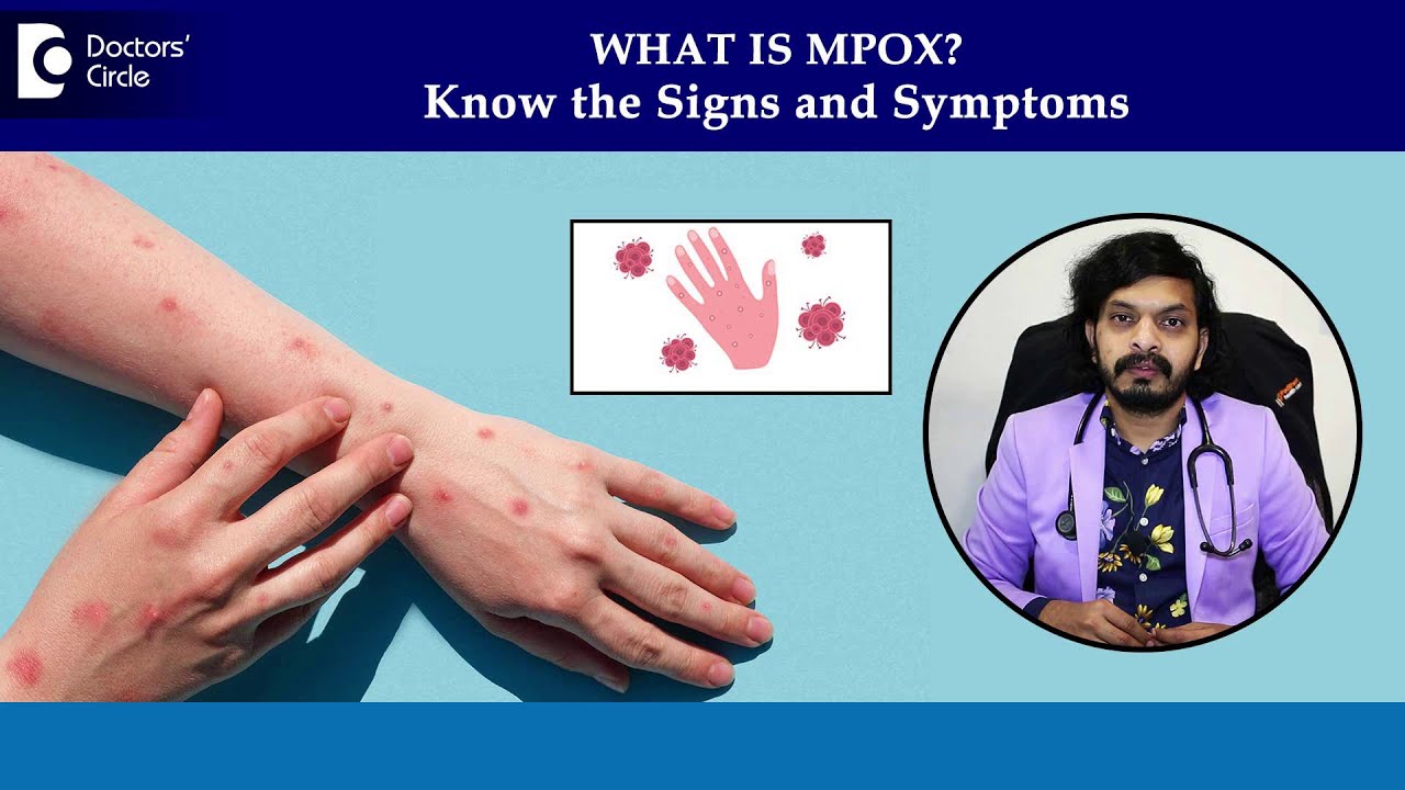 Monkeypox rash on skin | MPox Symptoms & Diagnosis| Mpox Phases-Dr.Leela Mohan P V R|Doctors' Circle