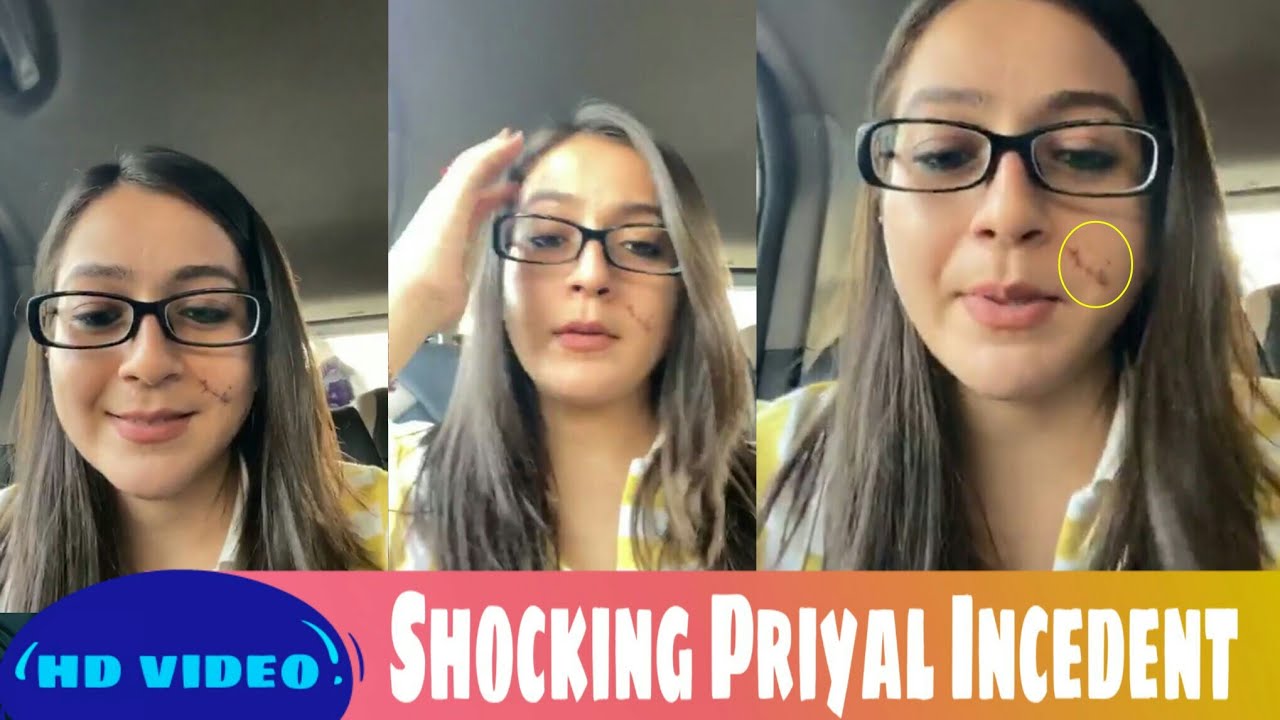 Shocking Priyal gor Injured her check badly | Maaya 2 Fame Priyal Gor | Telly Gossips
