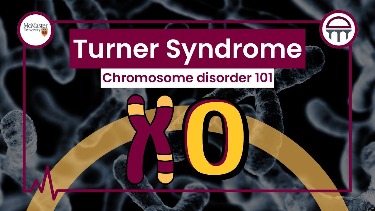 Turner Syndrome 101
