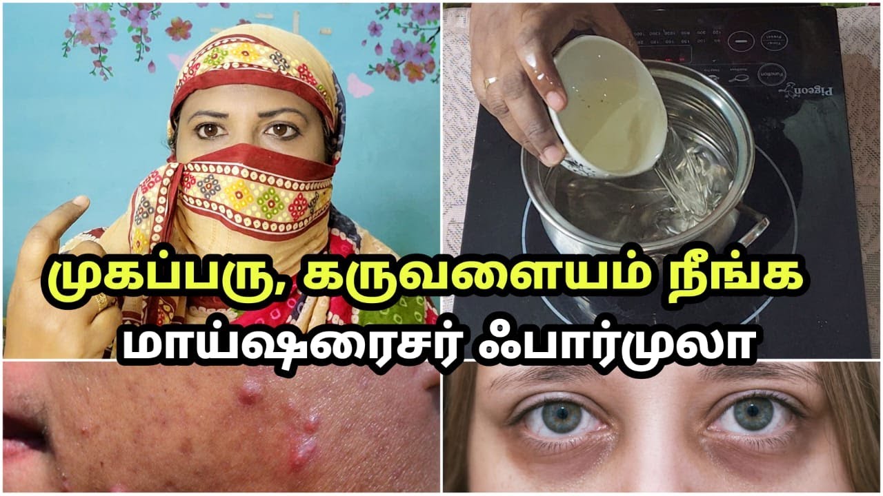 முகப்பரு கருவளையம் நீங்க நாமே செய்யலாம் மாய்ஷரைசர் - புதுமையான ஃபார்முலா - ASK Jhansi