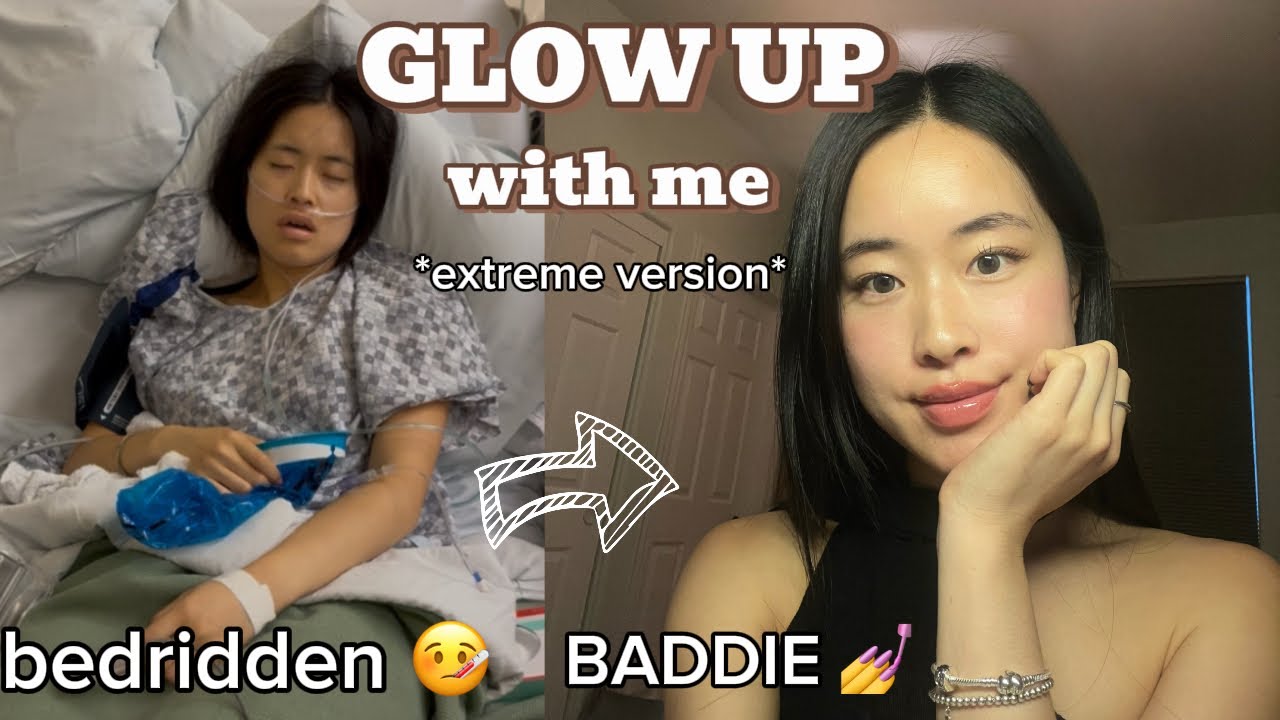 EXTREME GLOW UP FOR 2026 *post-surgery edition*