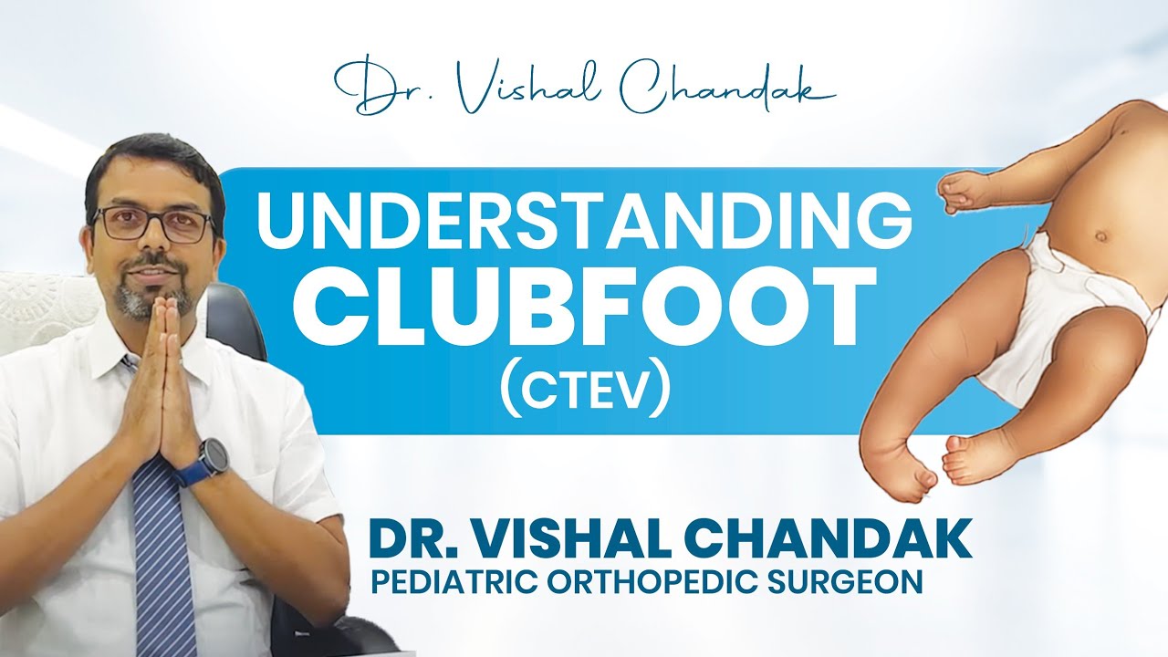 Understanding Clubfoot (CTEV) | Dr. Vishal Chandak | Pediatric Orthopedic Surgeon