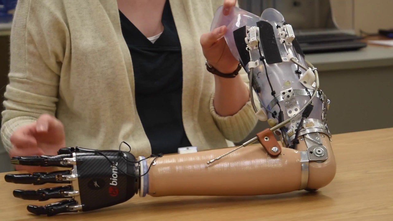 Using new technology to help amputees reconnect with the world