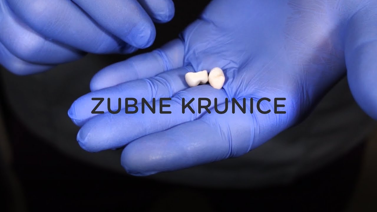 Zubne krunice - sve što trebate znati: Case study by dr. Filip Štimac